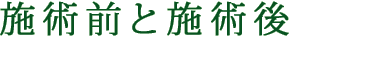 施術前と施術後